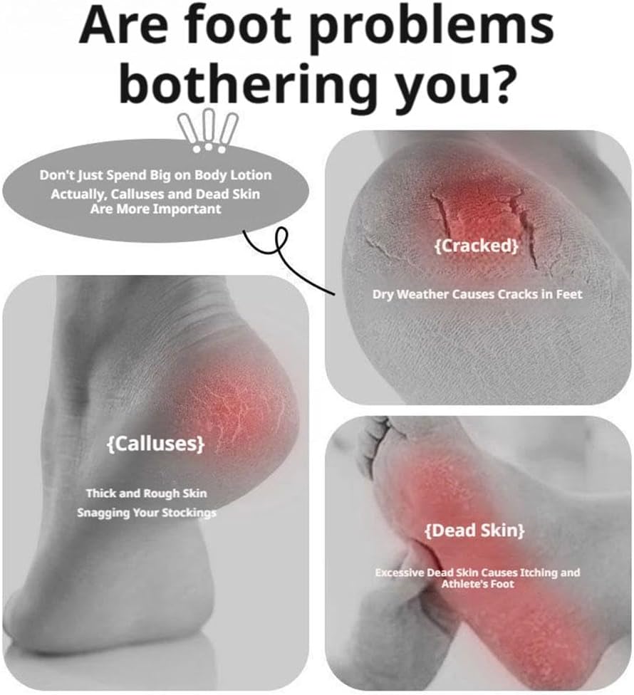 Novium Premium Foot Callus Remover