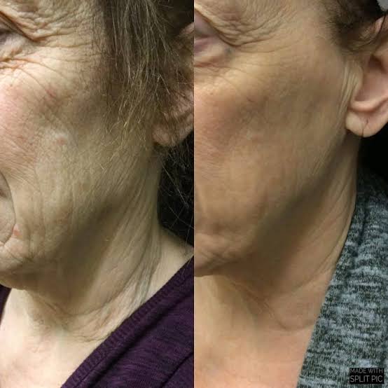 Magec by Novium Collagen Skin Tightening Cream