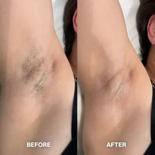 Novium Hair Removal Cream