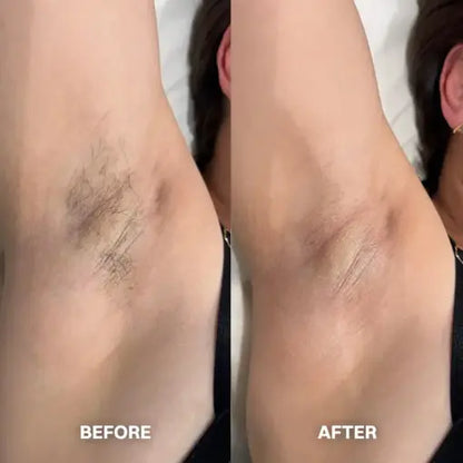 Novium Hair Removal Cream