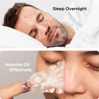 Novium nose patches